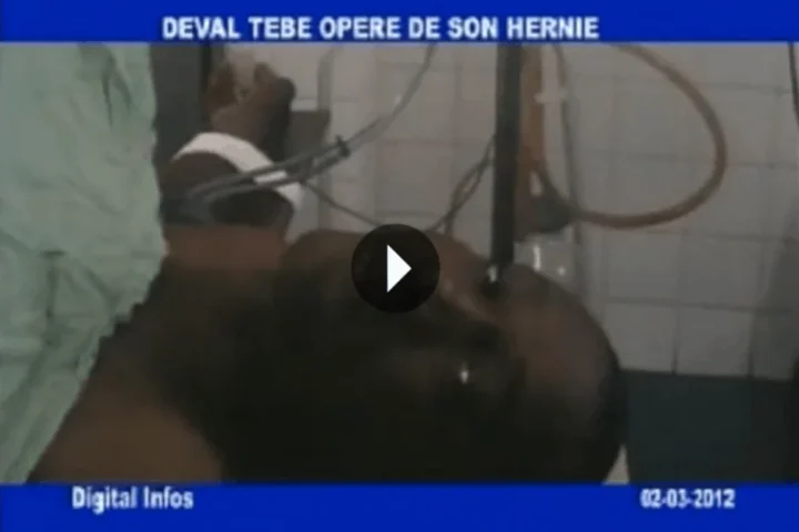 Deval Tebe