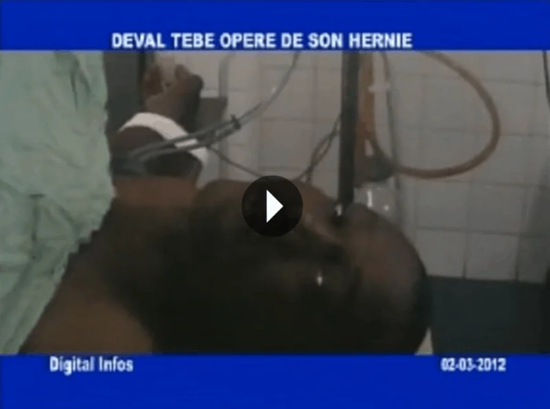 Deval Tebe